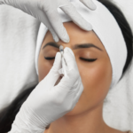 Botox treatment in delhi
